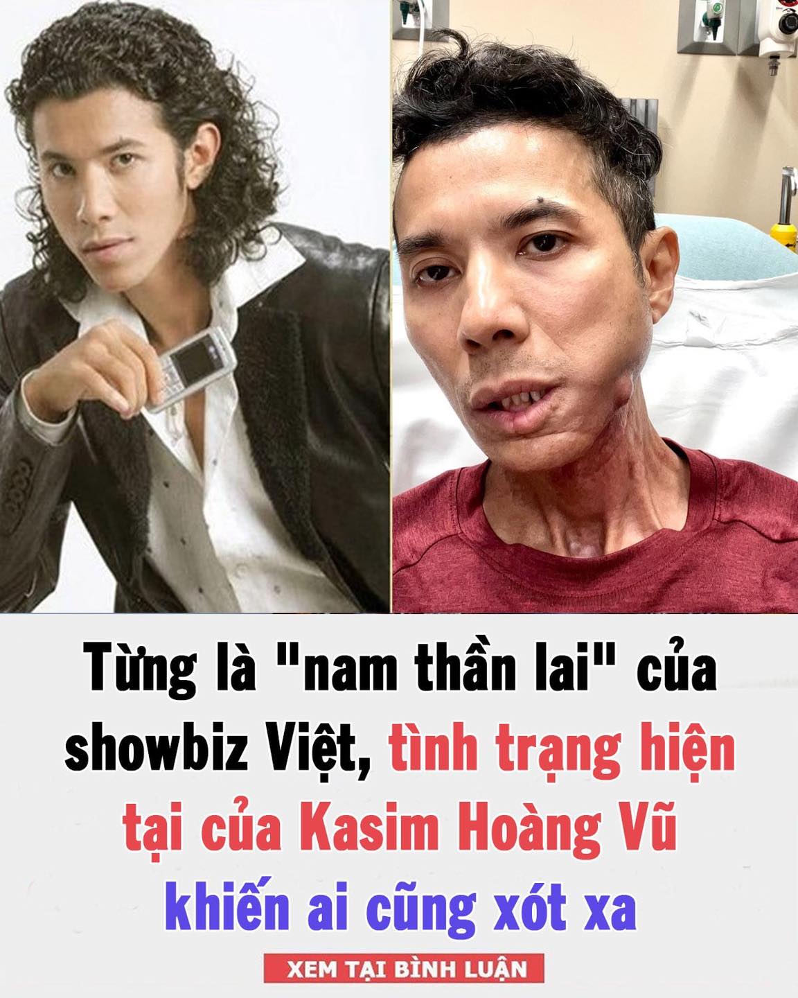 Tình trạng của Kasim Hoàng Vũ: Gầy rộc vì bạo bệnh, mệt mỏi run rẩy, mặt đau đớn không chịu nổi