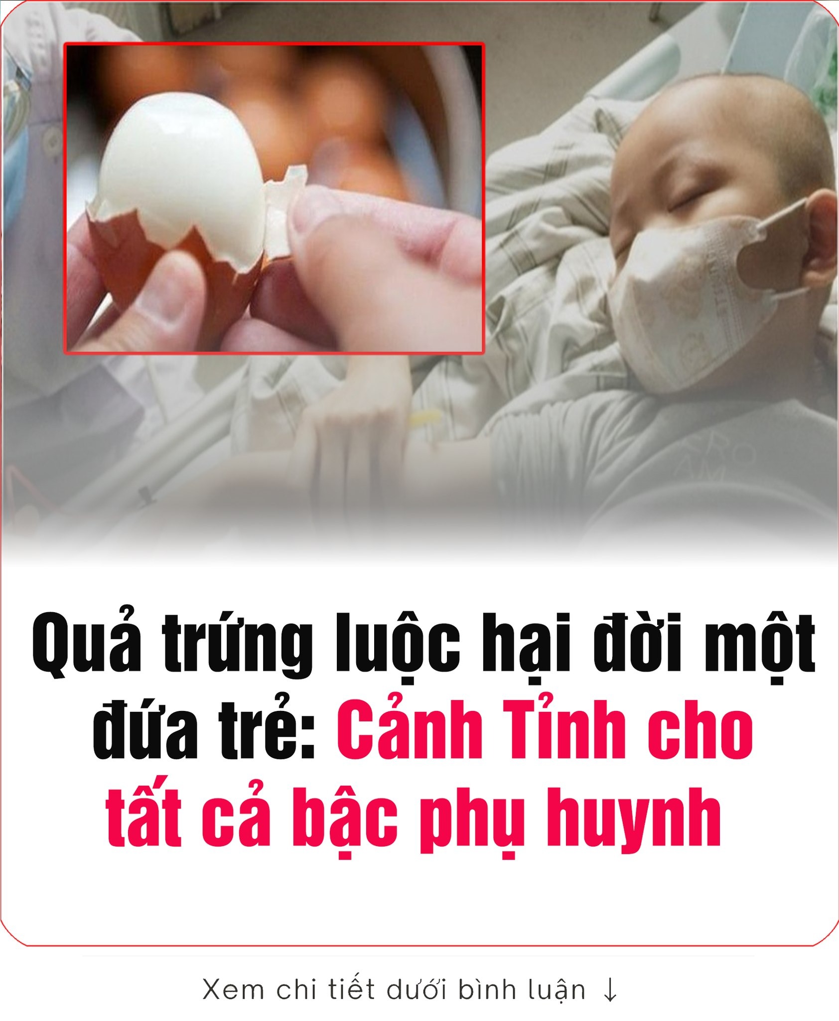 Ăn trứng luộc sai cách, cậu bé 4 tuổi không may “về với mây trời”: Bài học đắɫ giá cho gia đình có con nhỏ